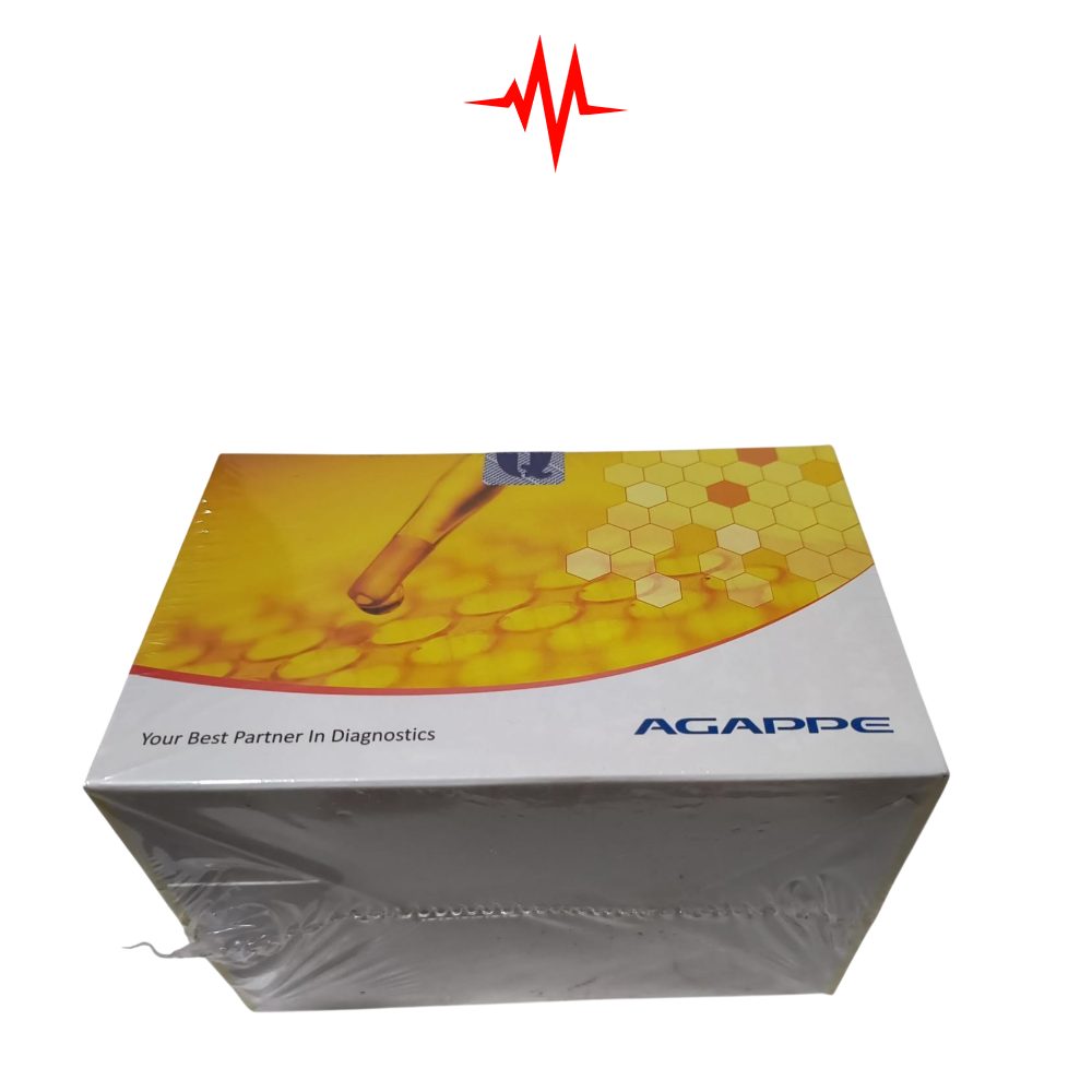 Agappe Salmonella typhi O Antigen Reagents – Widal Test Reagent for Typhoid Detection