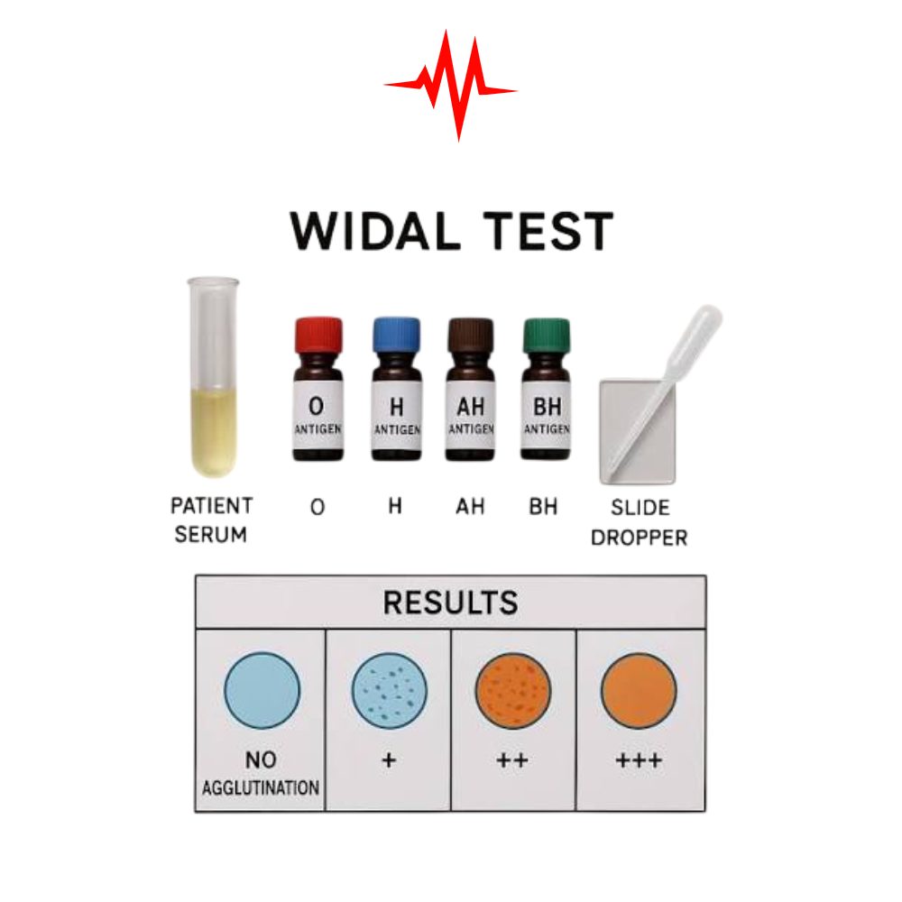 Professional Biolade Widal Test Kit – TO, TH, AH, BH Equipment