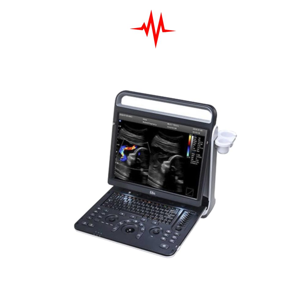 Precision Chison EBit 60 Ultrasound