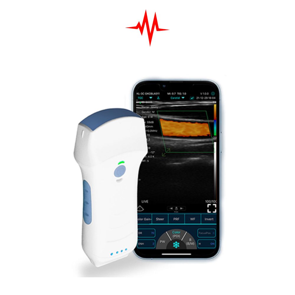 Precision Dual-Probes Multipurpose Wireless Ultrasound – Convex + linear + Cardiac Probe