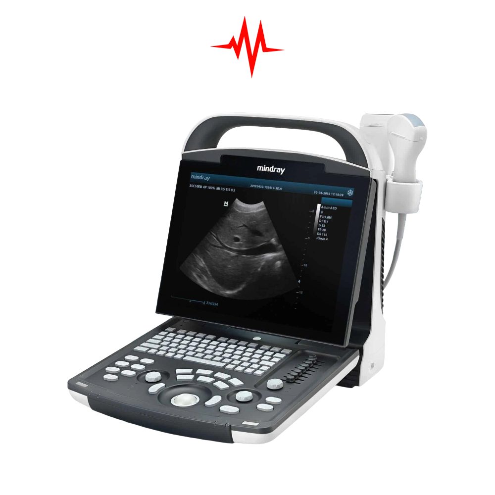 Precision MINDRAY DP-20 Ultrasound Machine