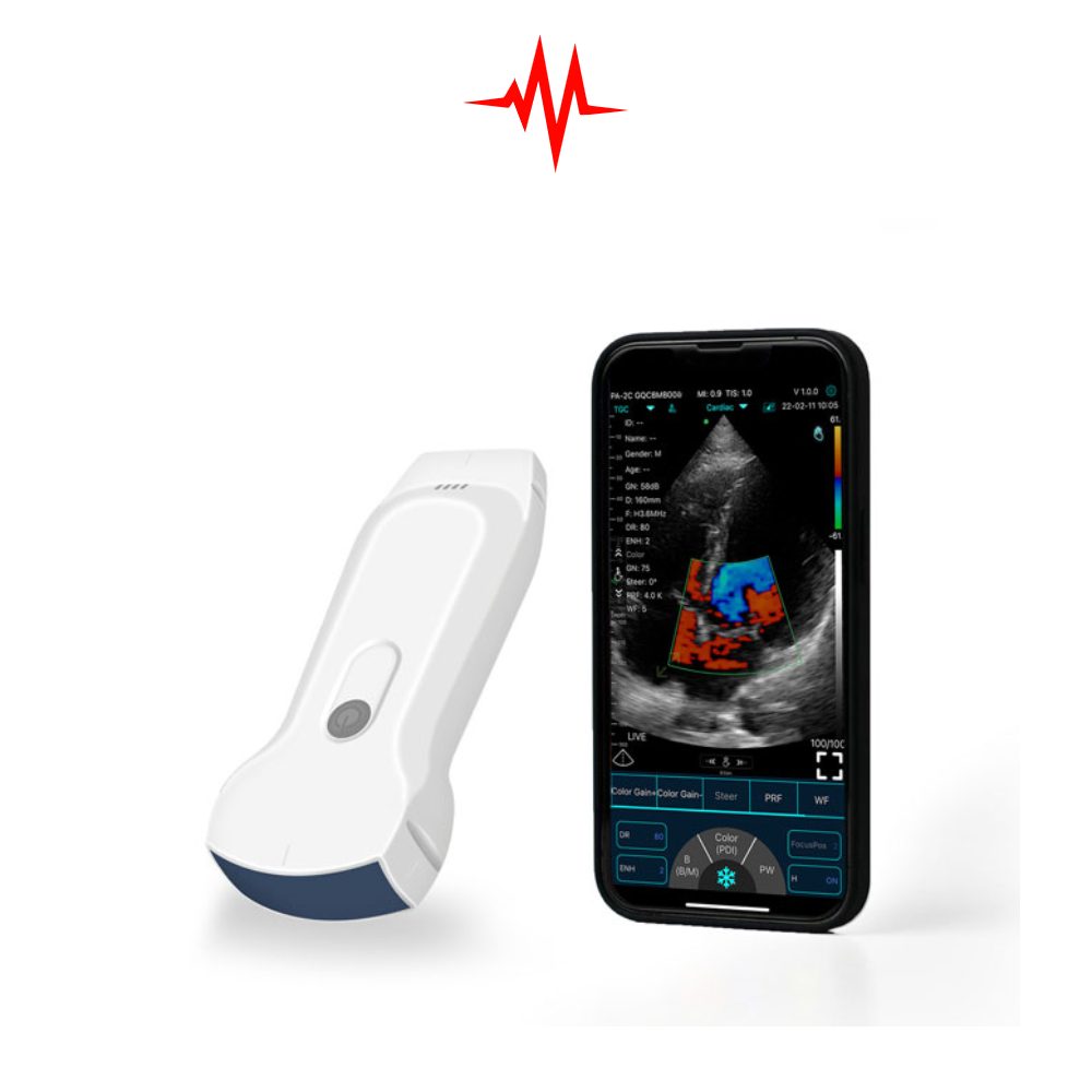 Portable Convex ultrasound Wireless Probe